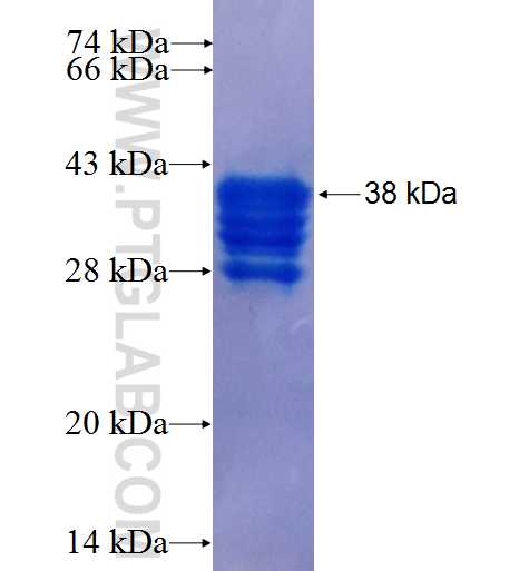 PCNT fusion protein Ag25888 SDS-PAGE