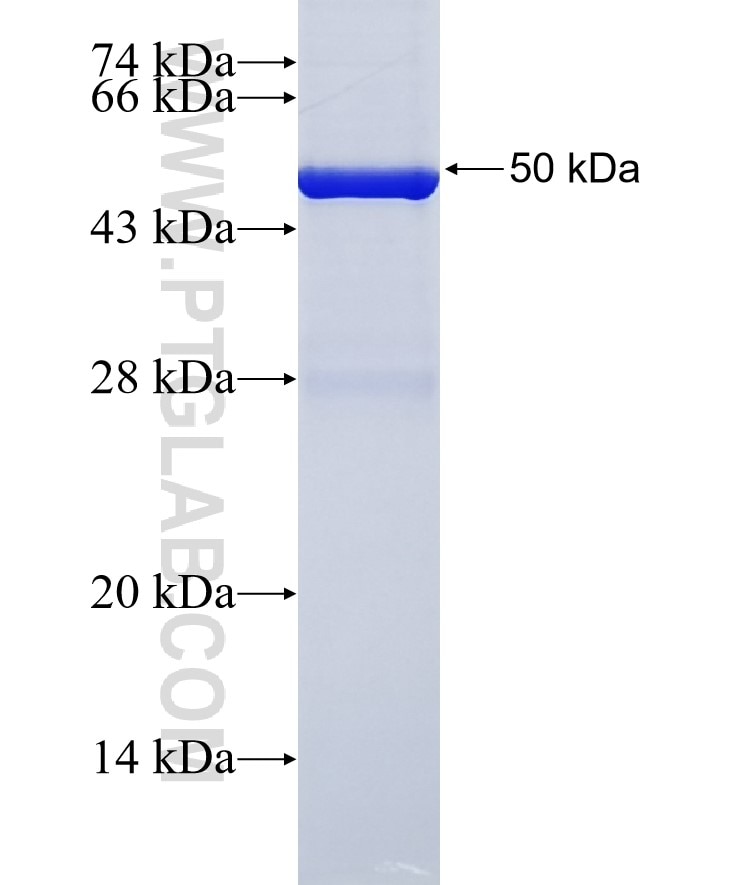 PCNX fusion protein Ag37954 SDS-PAGE