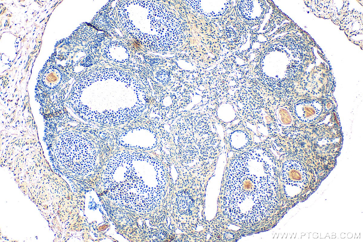 Immunohistochemical analysis of paraffin-embedded mouse ovary tissue slide using 14993-1-AP (PCOLCE antibody) at dilution of 1:400 (under 10x lens). Heat mediated antigen retrieval with Tris-EDTA buffer (pH 9.0). Immunohistochemistry (IHC) staining of mouse ovary tissue using PCOLCE Polyclonal antibody (14993-1-AP)