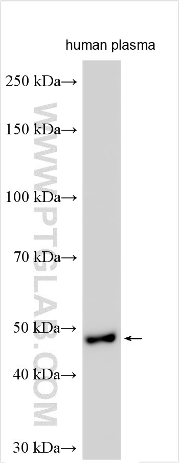 Western Blot (WB) analysis of various lysates using PCOLCE Polyclonal antibody (28826-1-AP)