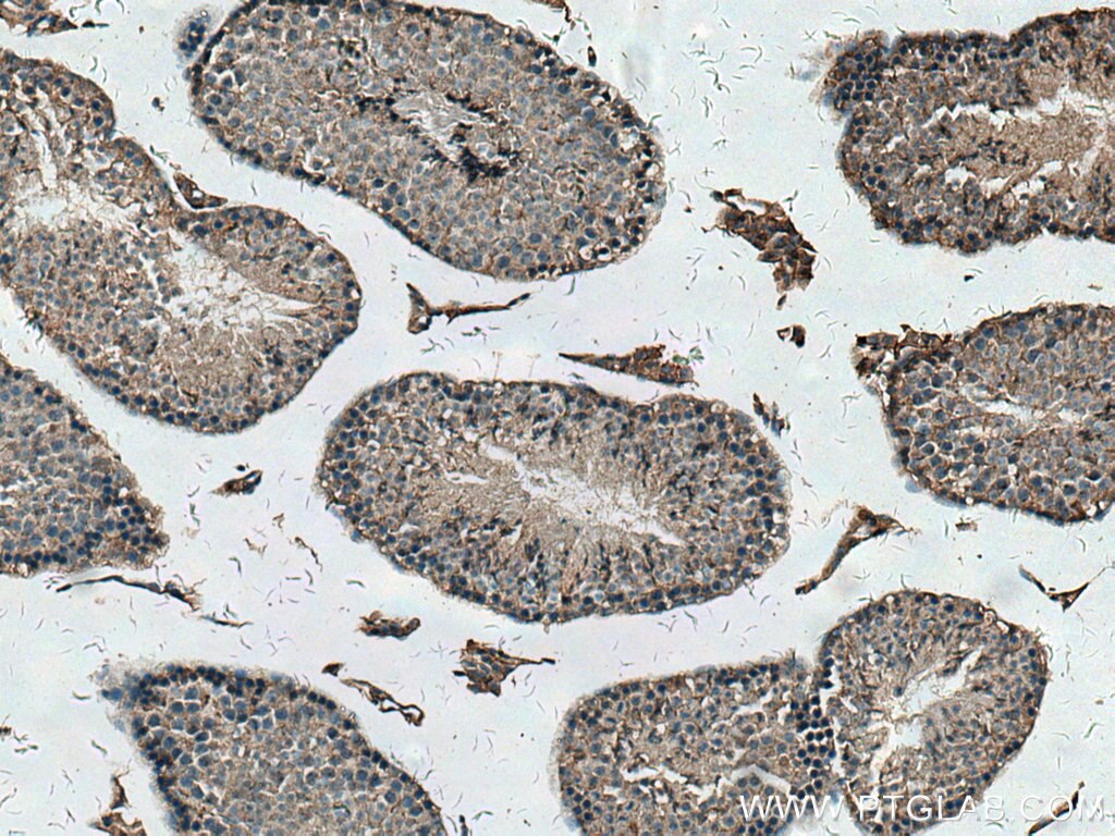 IHC staining of mouse testis using 24564-1-AP