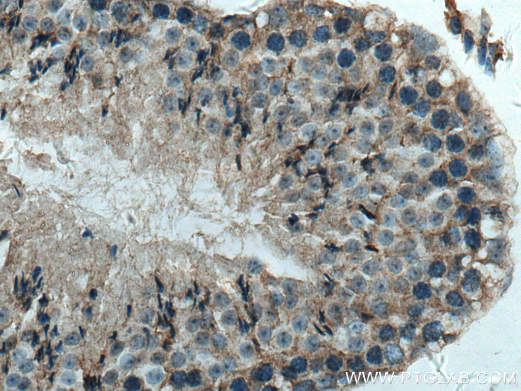 Immunohistochemistry (IHC) staining of mouse testis tissue using PCOTH Polyclonal antibody (24564-1-AP)