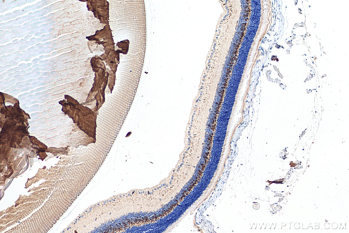 IHC staining of mouse eye using 13774-1-AP