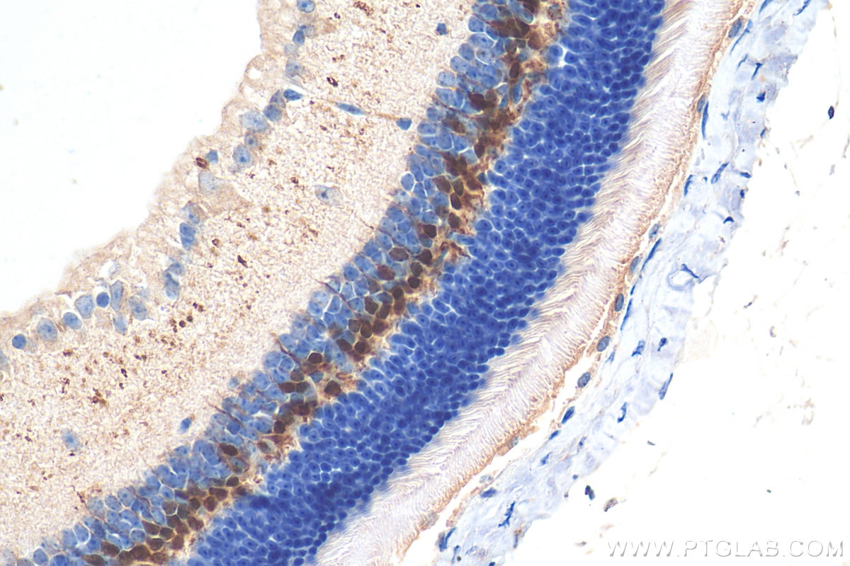 Immunohistochemistry (IHC) staining of mouse eye tissue using PCP2 Polyclonal antibody (13774-1-AP)