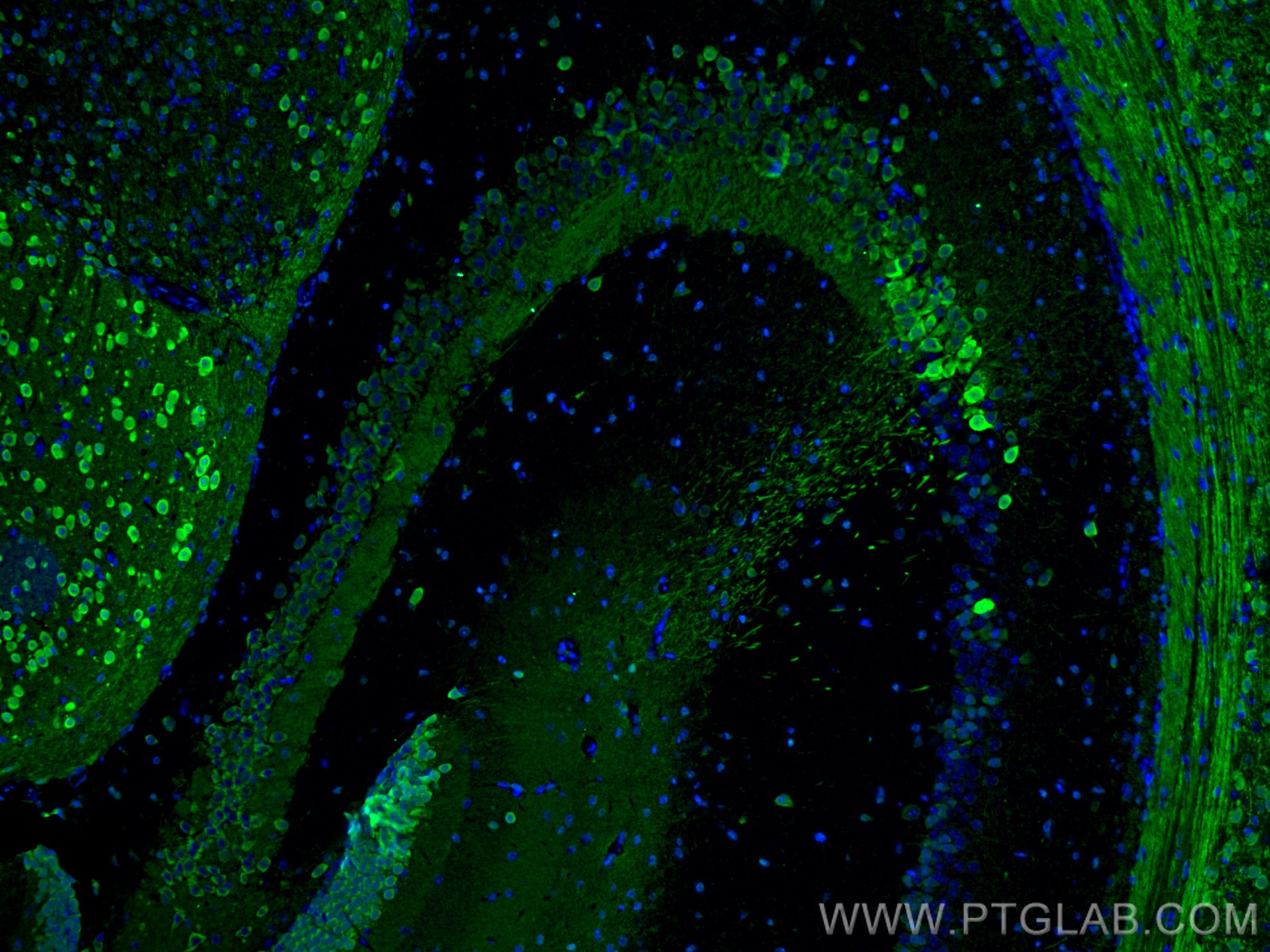 Immunofluorescence (IF) / fluorescent staining of mouse brain tissue using PCP4 Polyclonal antibody (14705-1-AP)