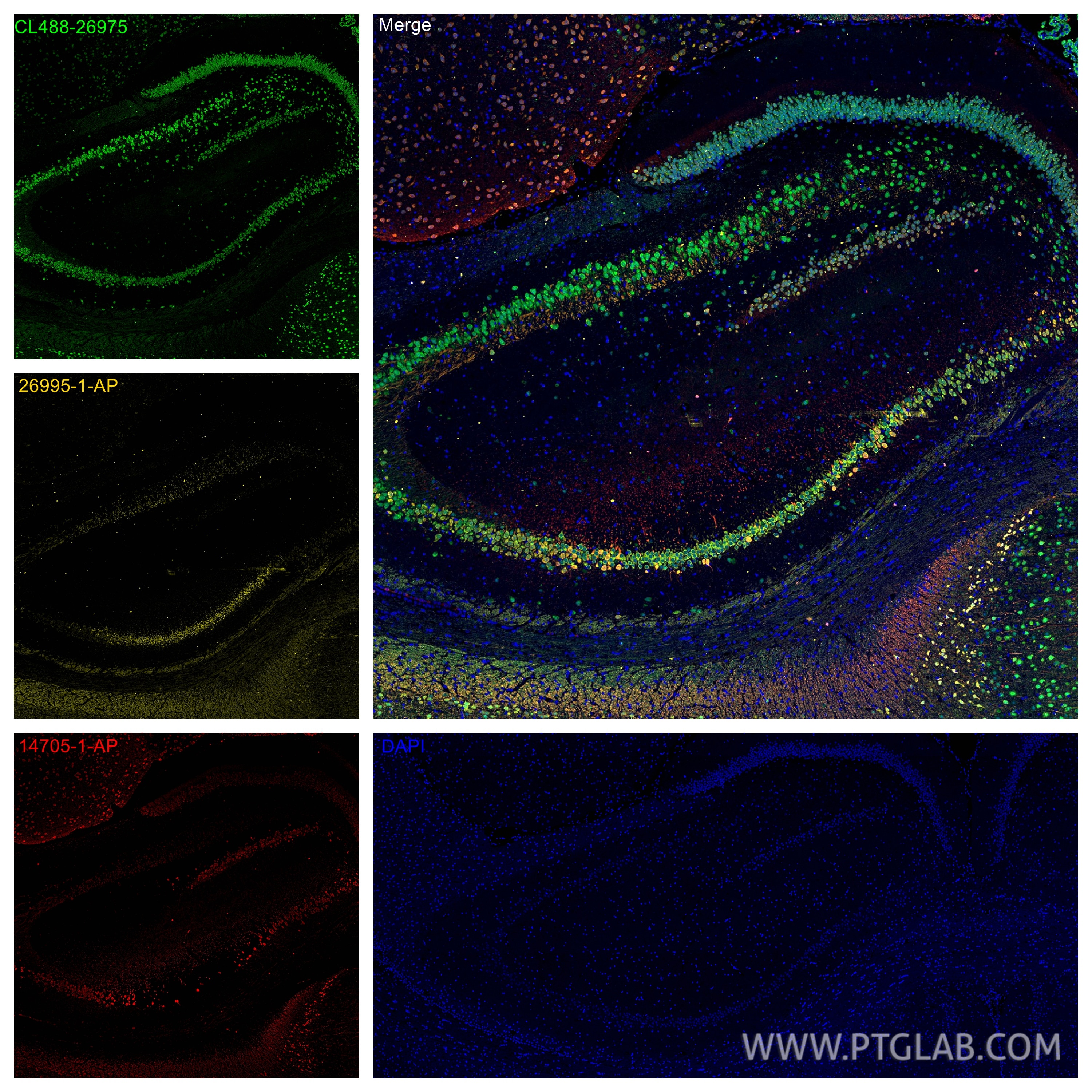 Immunofluorescence (IF) / fluorescent staining of rat brain tissue using PCP4 Polyclonal antibody (14705-1-AP)