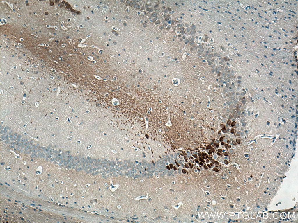 Immunohistochemistry (IHC) staining of mouse brain tissue using PCP4 Polyclonal antibody (14705-1-AP)