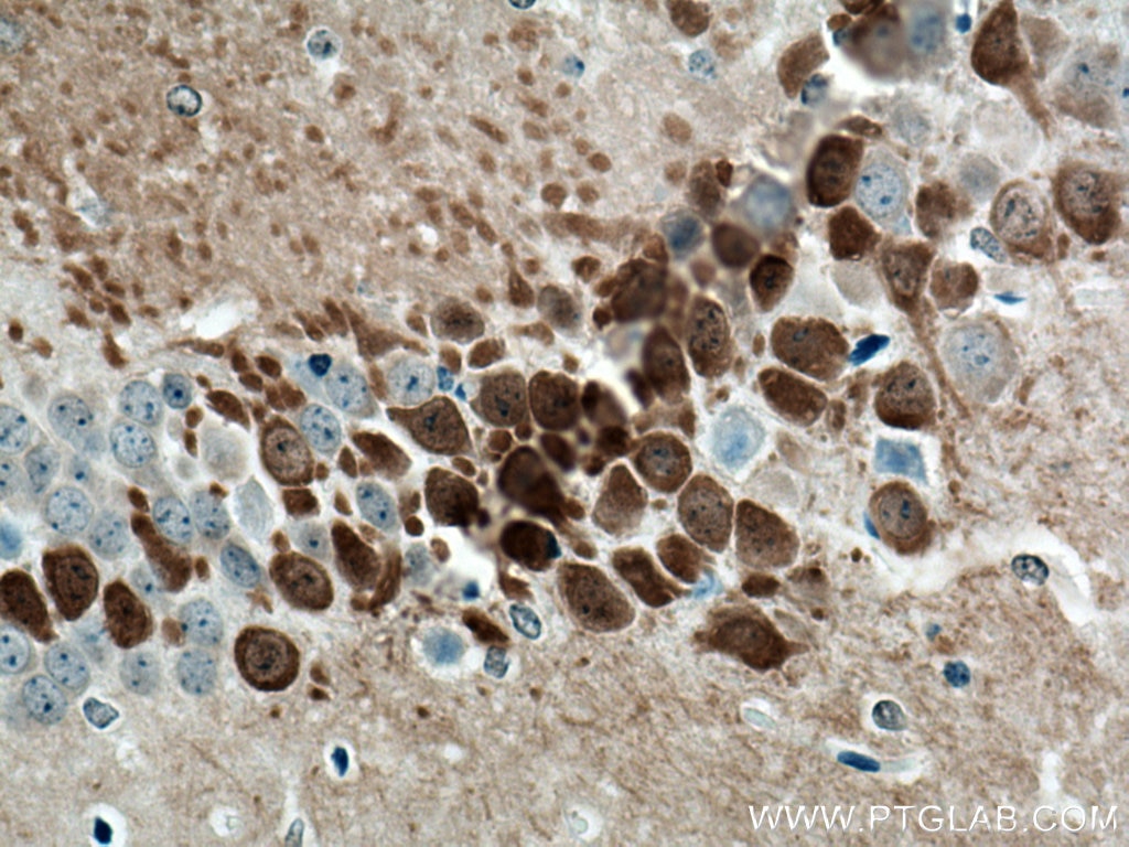 Immunohistochemistry (IHC) staining of mouse brain tissue using PCP4 Polyclonal antibody (14705-1-AP)