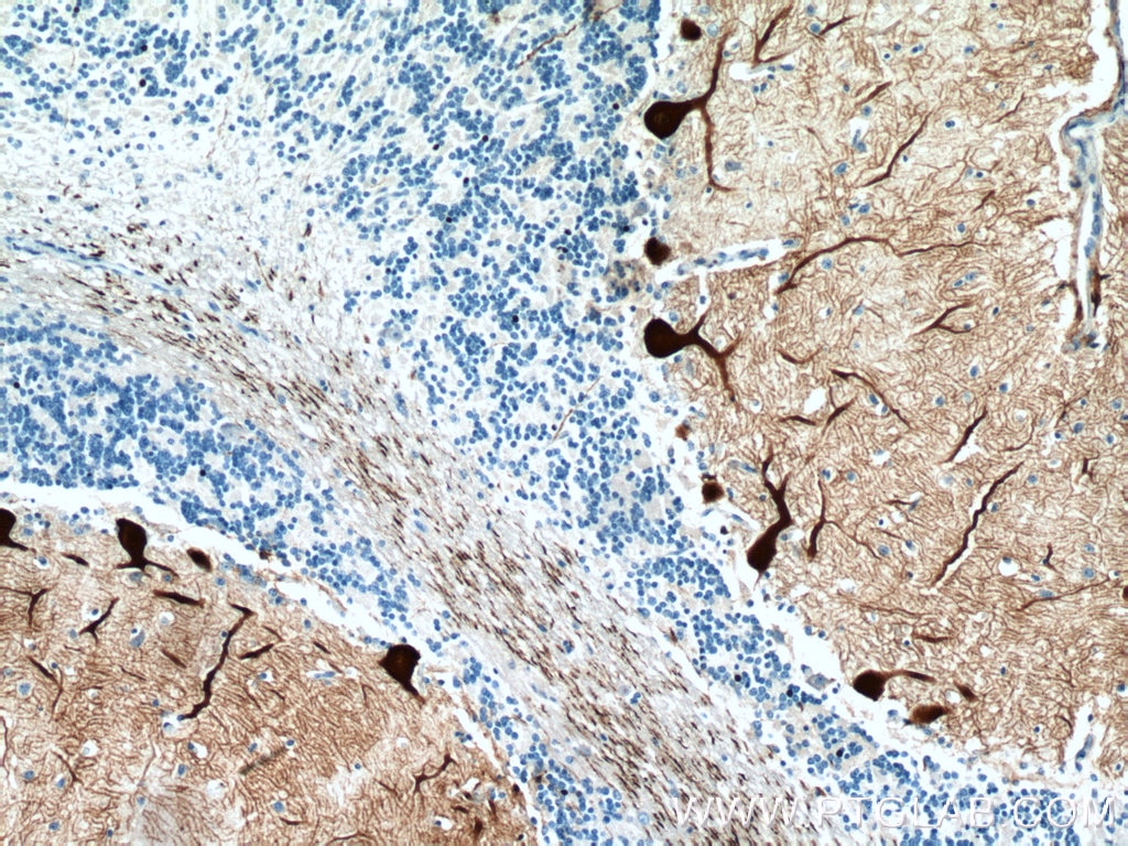 Immunohistochemistry (IHC) staining of human cerebellum tissue using PCP4 Polyclonal antibody (14705-1-AP)