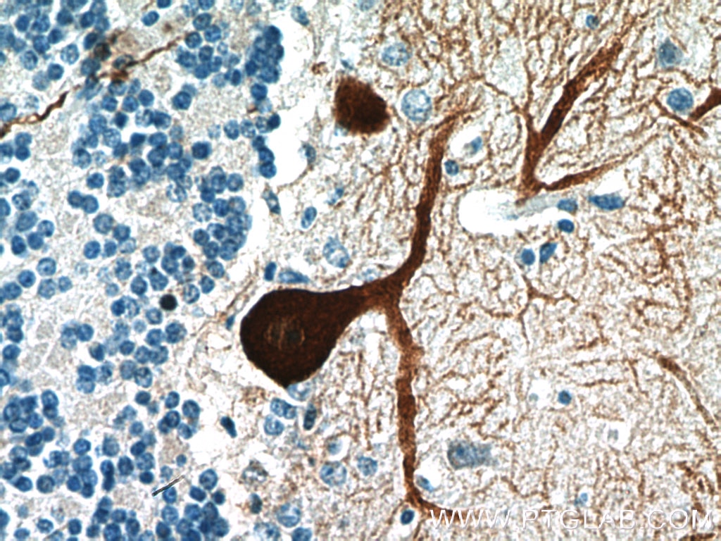 Immunohistochemistry (IHC) staining of human cerebellum tissue using PCP4 Polyclonal antibody (14705-1-AP)