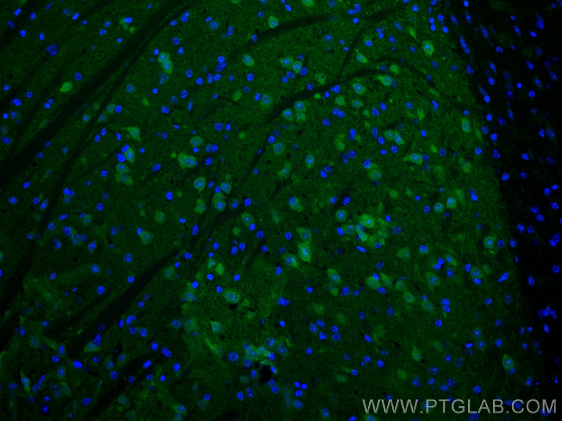 IF Staining of mouse brain using CL488-14705