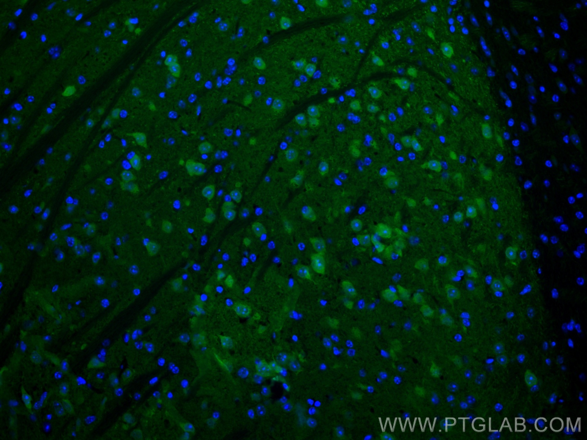 Immunofluorescence (IF) / fluorescent staining of mouse brain tissue using CoraLite® Plus 488-conjugated PCP4 Polyclonal anti (CL488-14705)