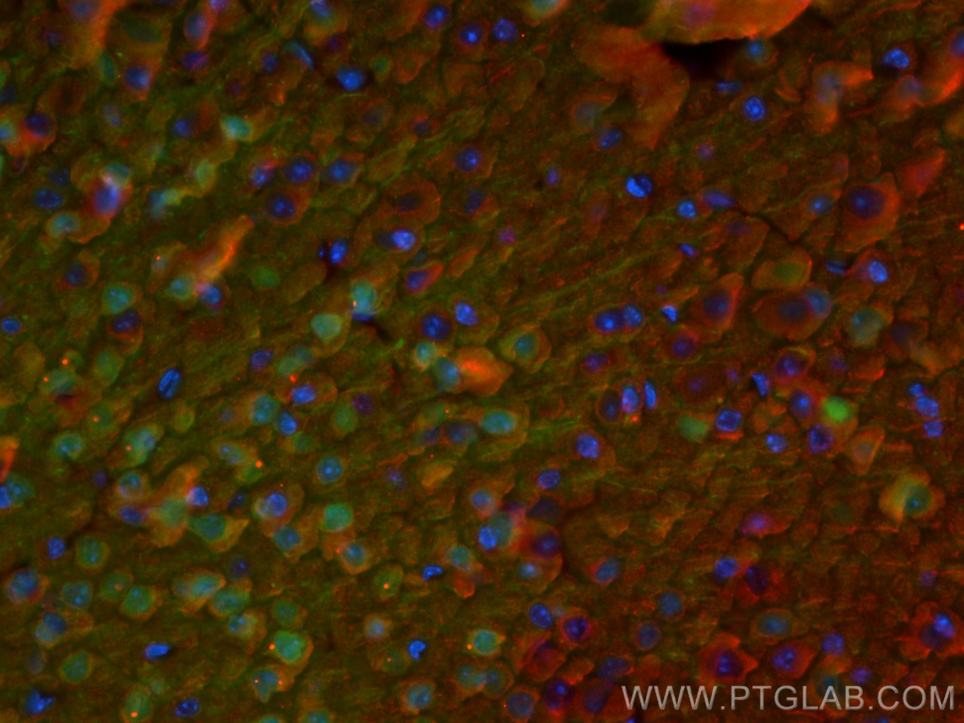 Immunofluorescence (IF) / fluorescent staining of mouse brain tissue using CoraLite® Plus 488-conjugated PCP4 Polyclonal anti (CL488-14705)