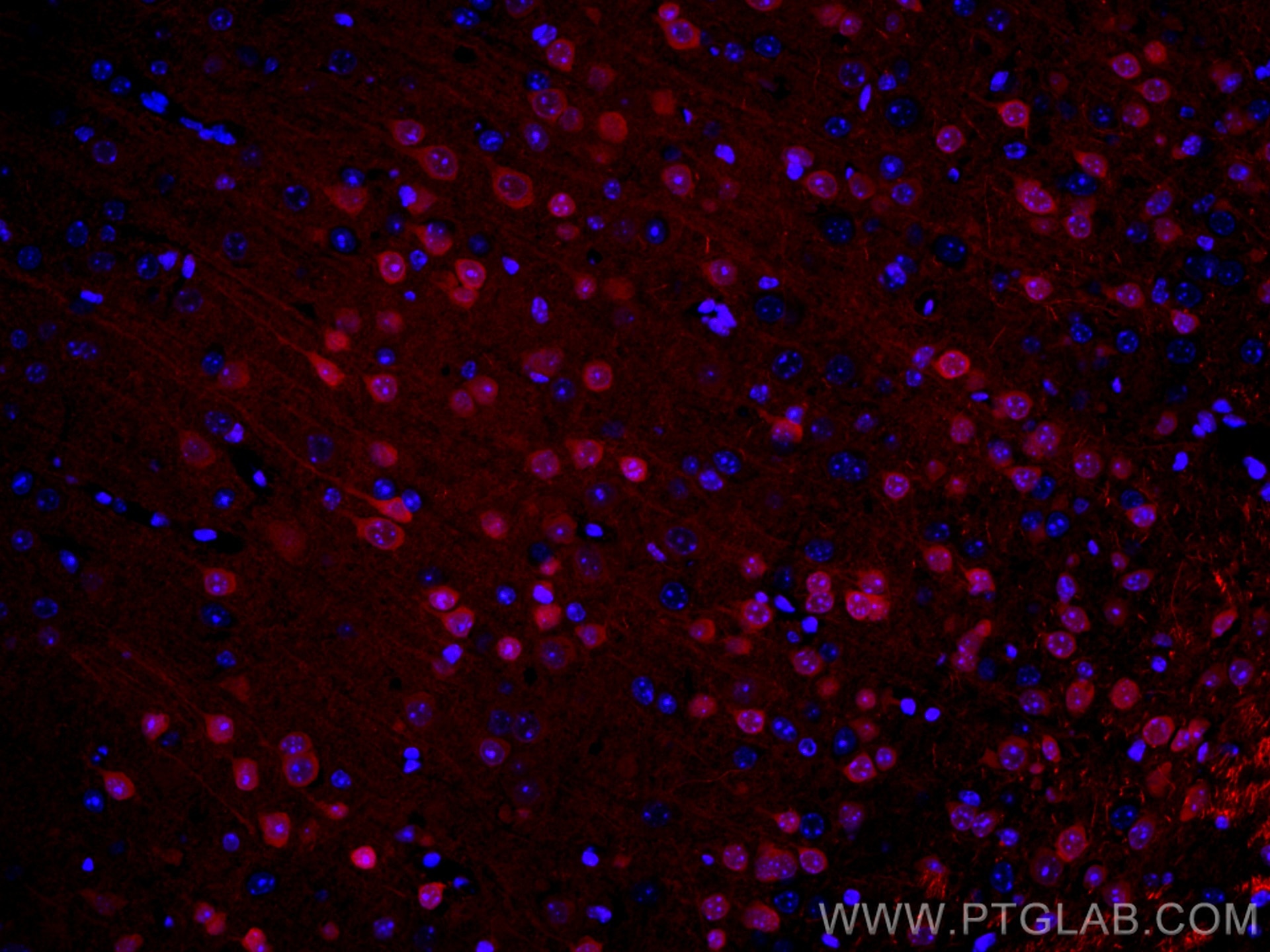 Immunofluorescence (IF) / fluorescent staining of mouse brain tissue using CoraLite®594-conjugated PCP4 Polyclonal antibody (CL594-14705)