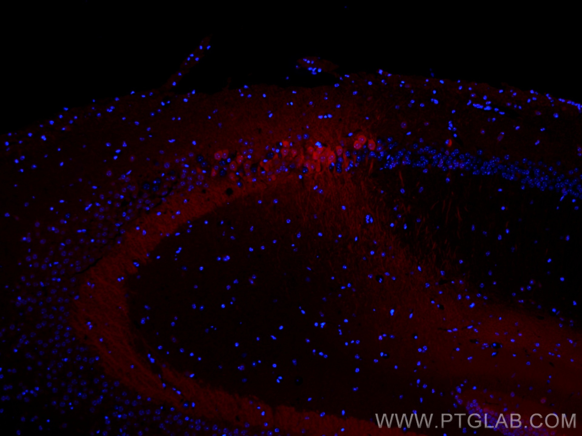 Immunofluorescence (IF) / fluorescent staining of mouse brain tissue using CoraLite®594-conjugated PCP4 Polyclonal antibody (CL594-14705)