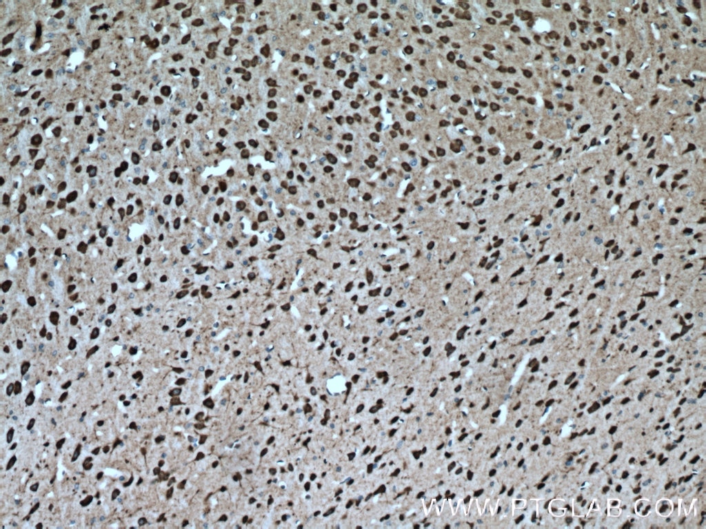 Immunohistochemistry (IHC) staining of mouse brain tissue using PCP4L1 Polyclonal antibody (25933-1-AP)
