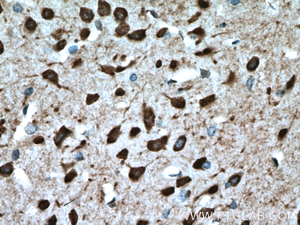 Immunohistochemistry (IHC) staining of mouse brain tissue using PCP4L1 Polyclonal antibody (25933-1-AP)