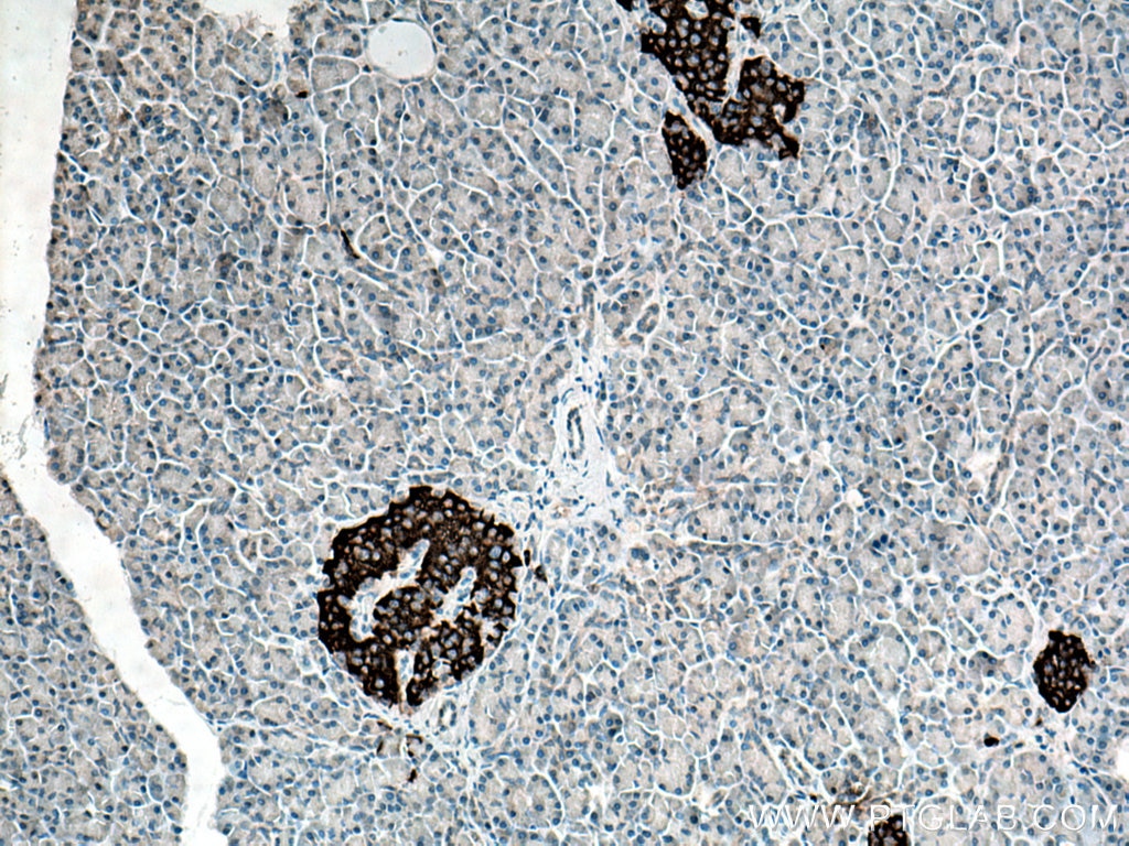 Immunohistochemistry (IHC) staining of human pancreas tissue using PCSK1 Polyclonal antibody (28219-1-AP)