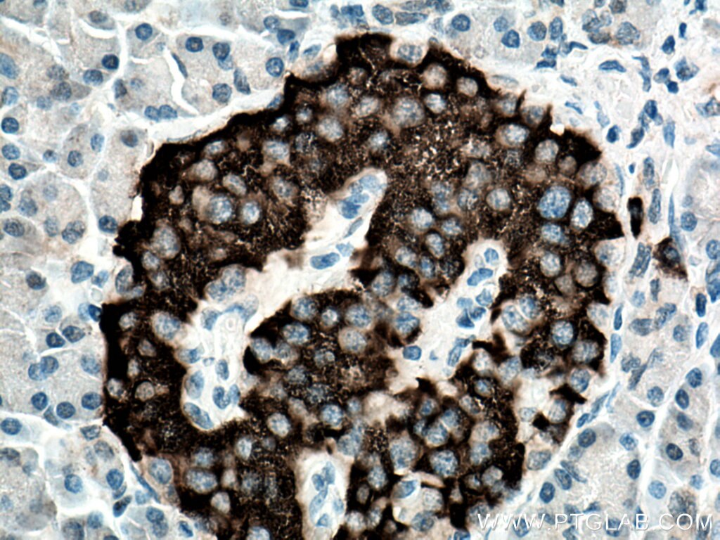 Immunohistochemistry (IHC) staining of human pancreas tissue using PCSK1 Polyclonal antibody (28219-1-AP)