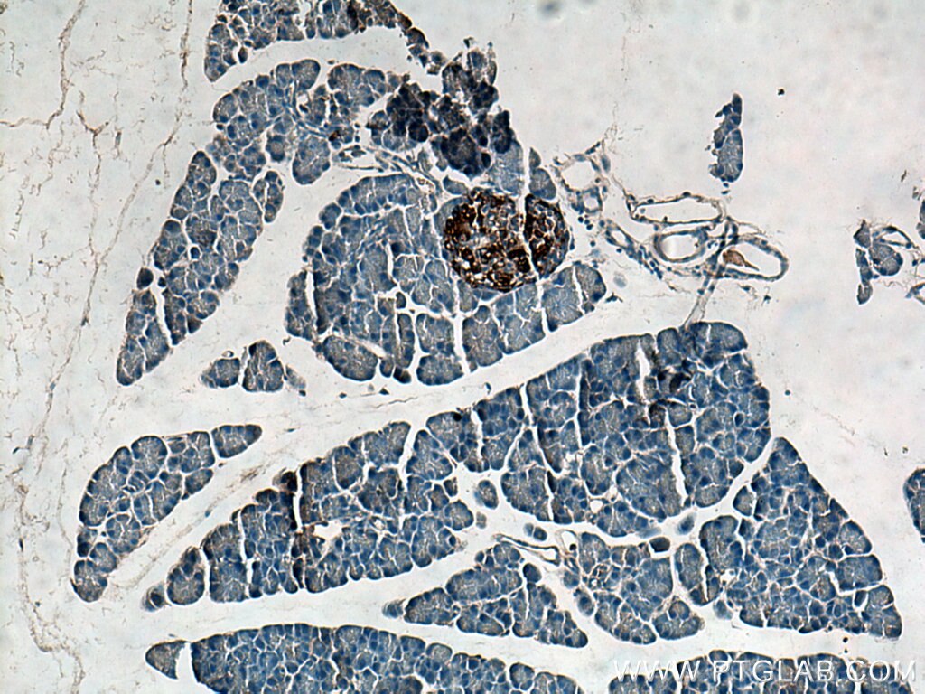 Immunohistochemistry (IHC) staining of mouse pancreas tissue using PCSK1 Polyclonal antibody (28219-1-AP)