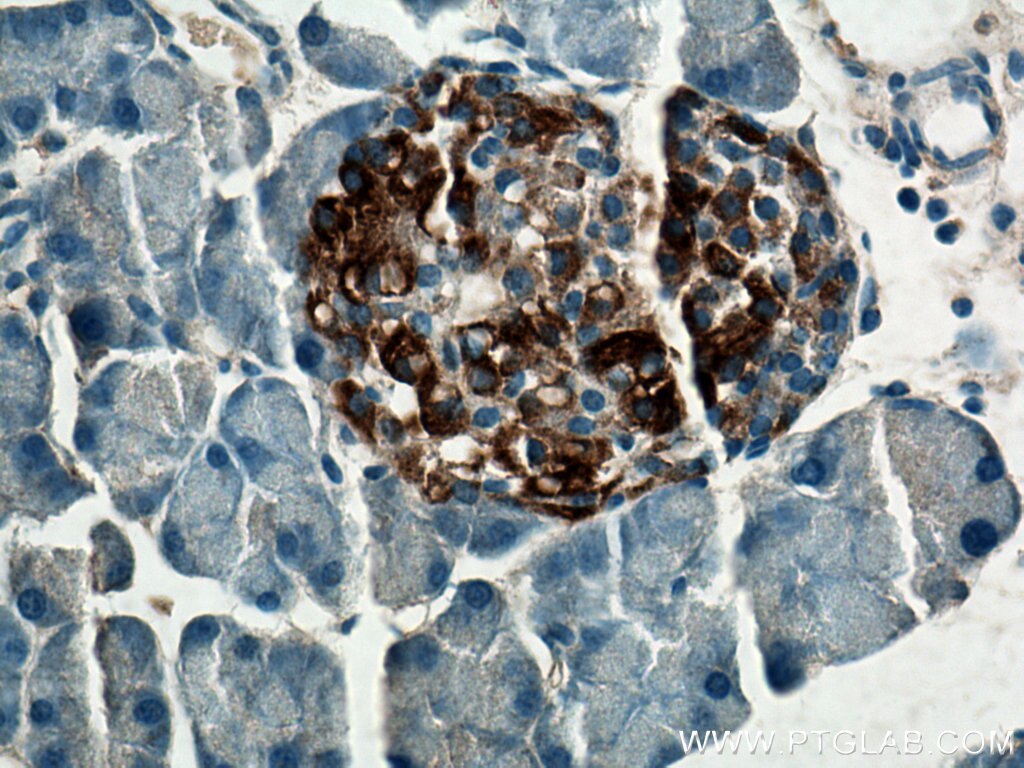 Immunohistochemistry (IHC) staining of mouse pancreas tissue using PCSK1 Polyclonal antibody (28219-1-AP)