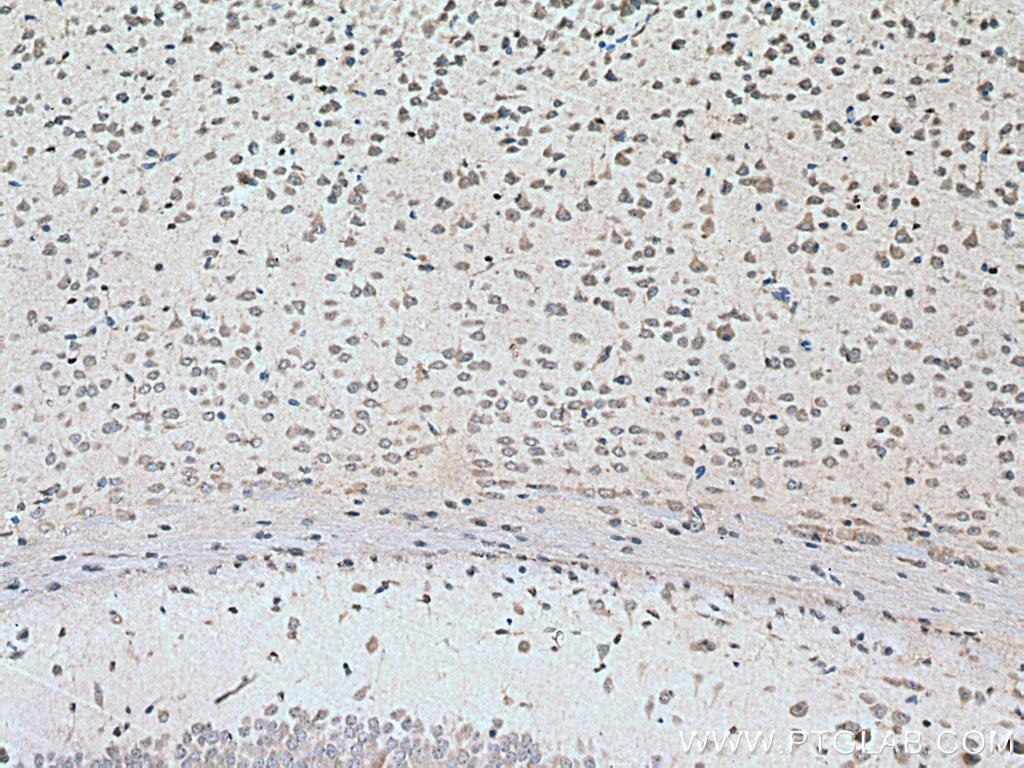 Immunohistochemistry (IHC) staining of mouse brain tissue using PCSK1 Polyclonal antibody (28219-1-AP)