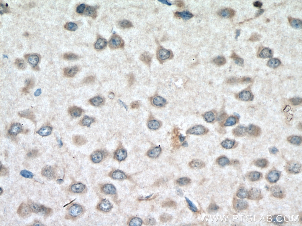 IHC staining of mouse brain using 28219-1-AP