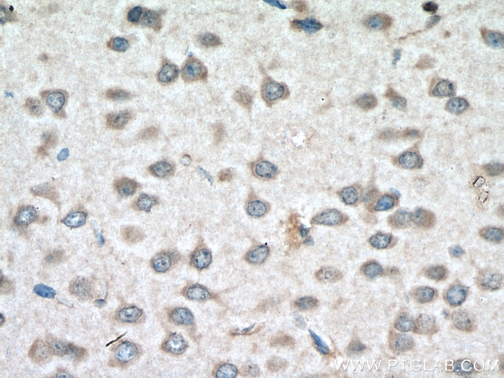 Immunohistochemistry (IHC) staining of mouse brain tissue using PCSK1 Polyclonal antibody (28219-1-AP)