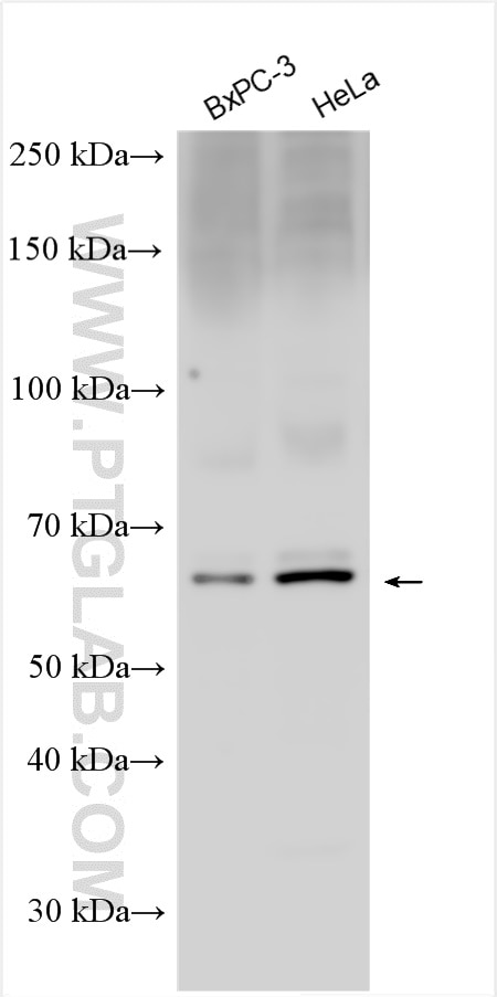 Western Blot (WB) analysis of various lysates using PCSK1 Polyclonal antibody (28219-1-AP)