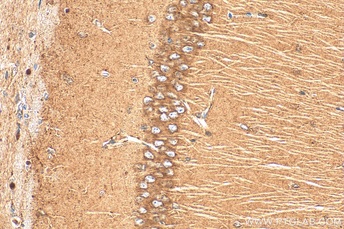 Immunohistochemistry (IHC) staining of mouse brain tissue using PCSK2 Polyclonal antibody (10553-1-AP)