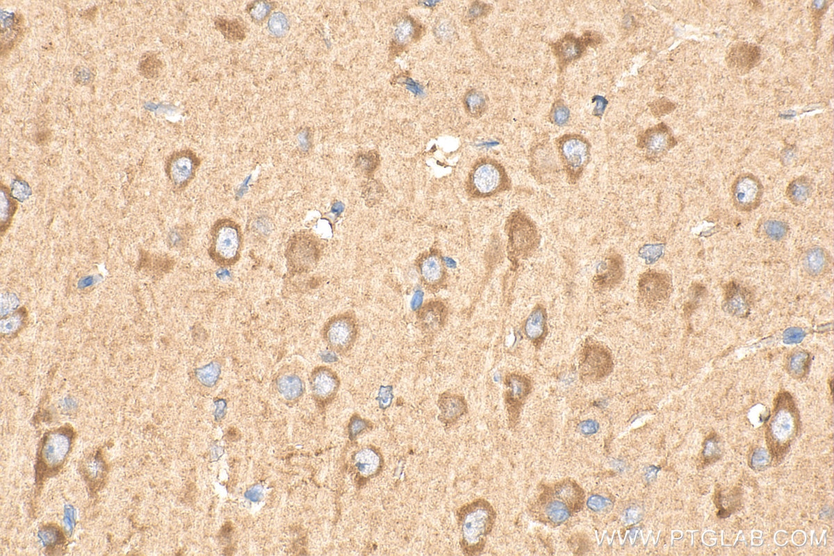 Immunohistochemistry (IHC) staining of rat brain tissue using PCSK2 Polyclonal antibody (10553-1-AP)