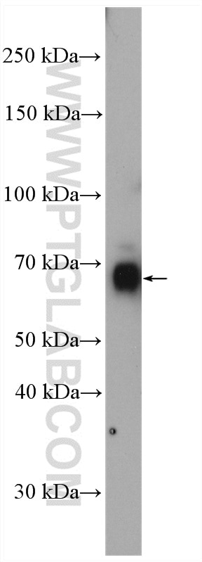 Western Blot (WB) analysis of mouse cerebellum tissue using PCSK2 Polyclonal antibody (10553-1-AP)