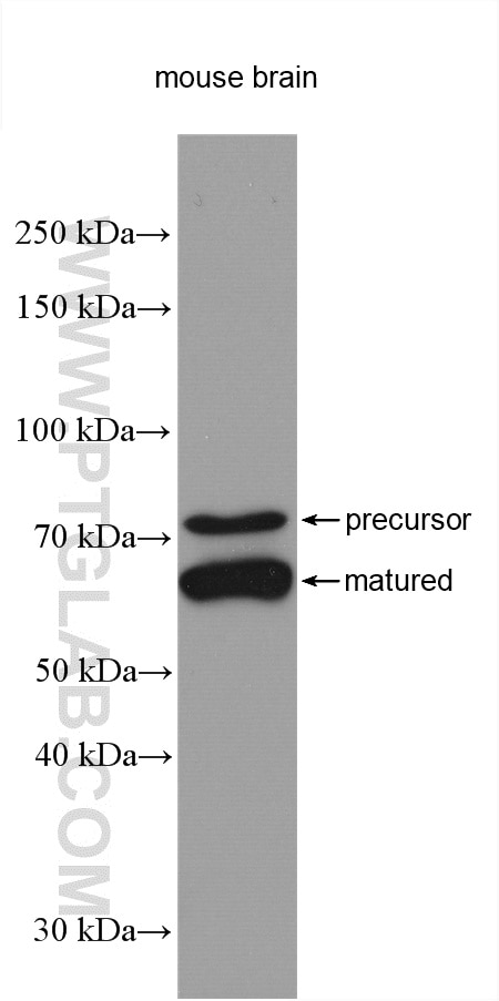 Western Blot (WB) analysis of various lysates using human PCSK2 Polyclonal antibody (10553-1-AP)