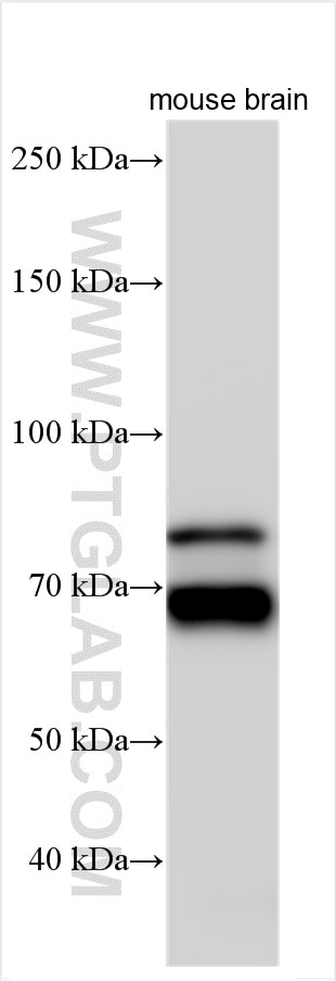 Western Blot (WB) analysis of various lysates using human PCSK2 Polyclonal antibody (10553-1-AP)