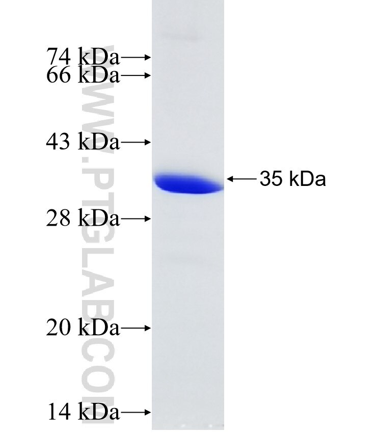 PCSK2 fusion protein Ag27919 SDS-PAGE