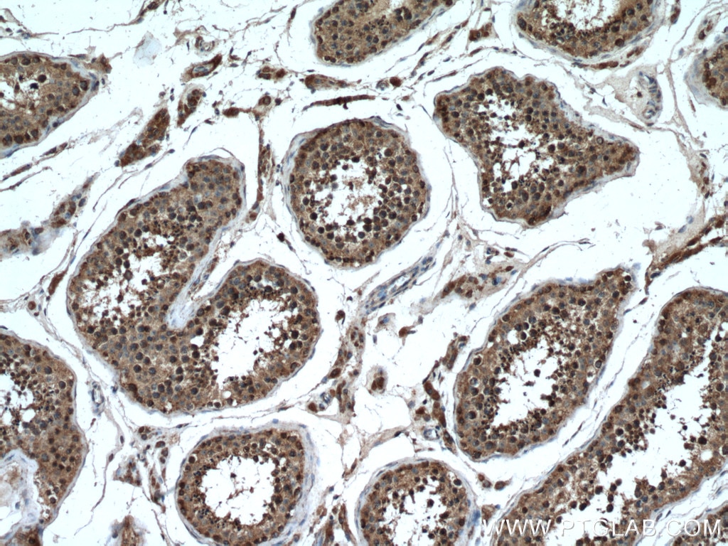 Immunohistochemistry (IHC) staining of human testis tissue using PCSK4 Polyclonal antibody (15106-1-AP)