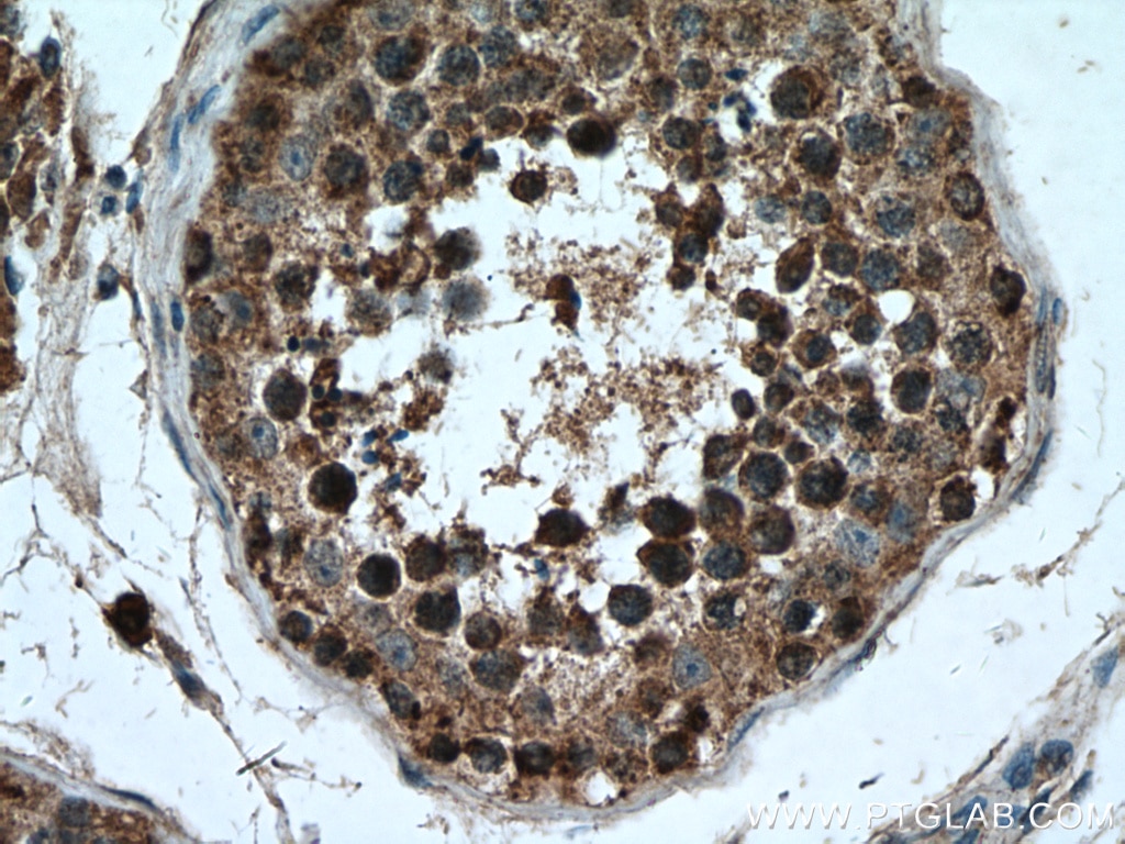 Immunohistochemistry (IHC) staining of human testis tissue using PCSK4 Polyclonal antibody (15106-1-AP)