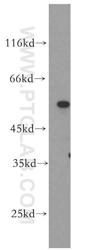 Western Blot (WB) analysis of human testis tissue using PCSK4 Polyclonal antibody (15106-1-AP)