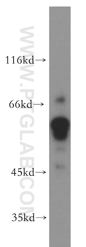 Western Blot (WB) analysis of human placenta tissue using PCSK4 Polyclonal antibody (15106-1-AP)