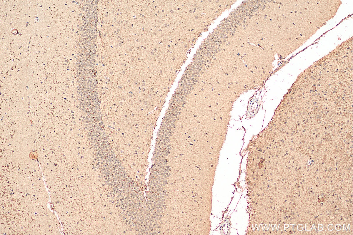 Immunohistochemistry (IHC) staining of mouse brain tissue using PCSK5 Polyclonal antibody (16470-1-AP)
