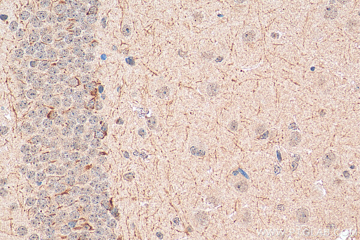 Immunohistochemistry (IHC) staining of mouse brain tissue using PCSK5 Polyclonal antibody (16470-1-AP)