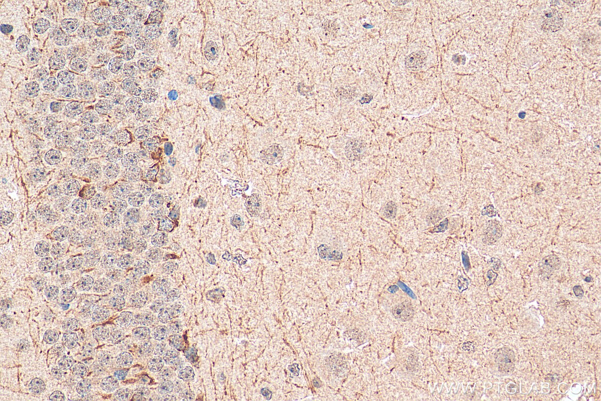 Immunohistochemistry (IHC) staining of mouse brain tissue using PCSK5 Polyclonal antibody (16470-1-AP)