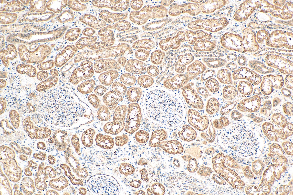 Immunohistochemistry (IHC) staining of human kidney tissue using PCSK5 Polyclonal antibody (16470-1-AP)