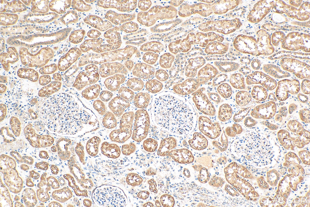 IHC staining of human kidney using 16470-1-AP