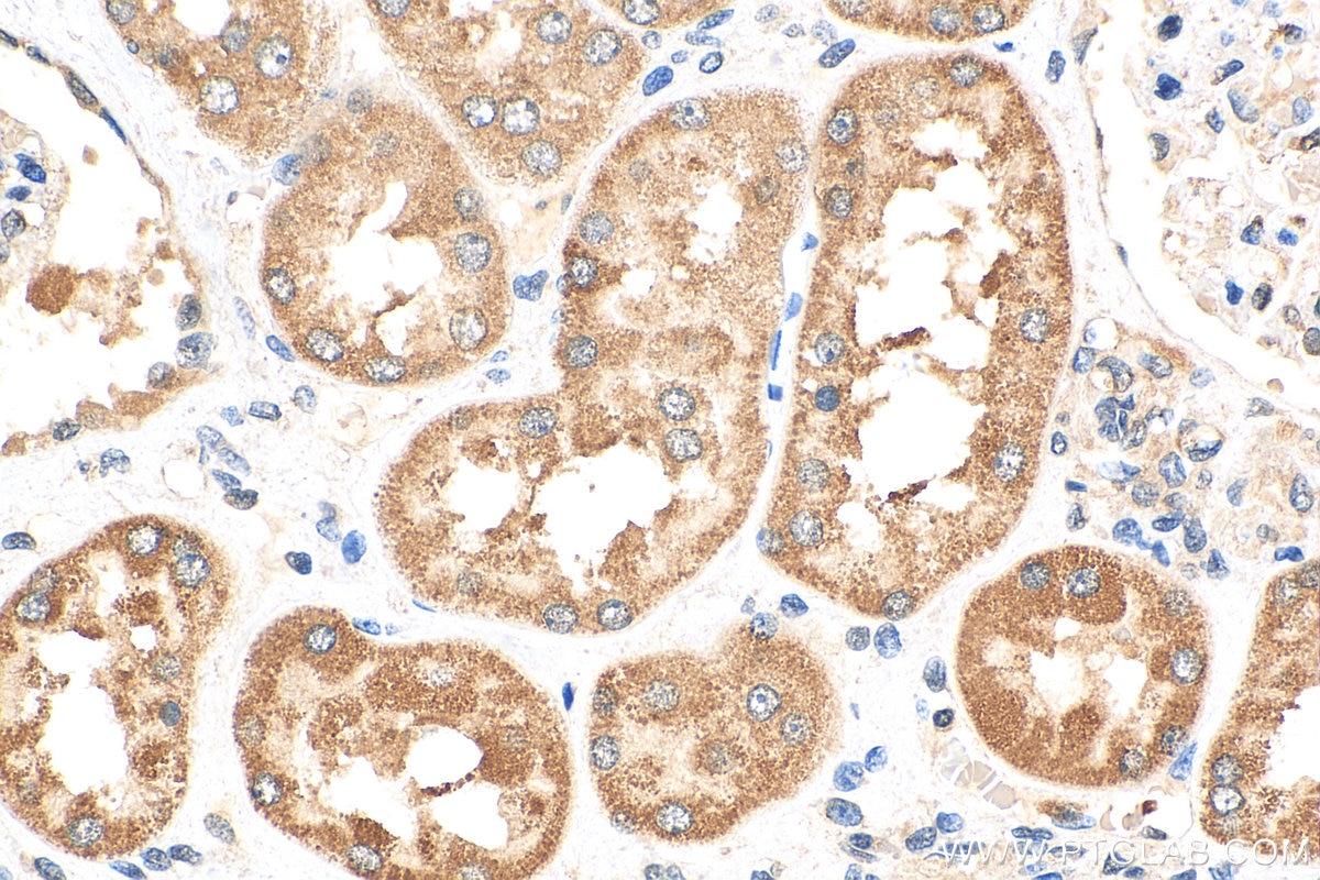 Immunohistochemistry (IHC) staining of human kidney tissue using PCSK5 Polyclonal antibody (16470-1-AP)