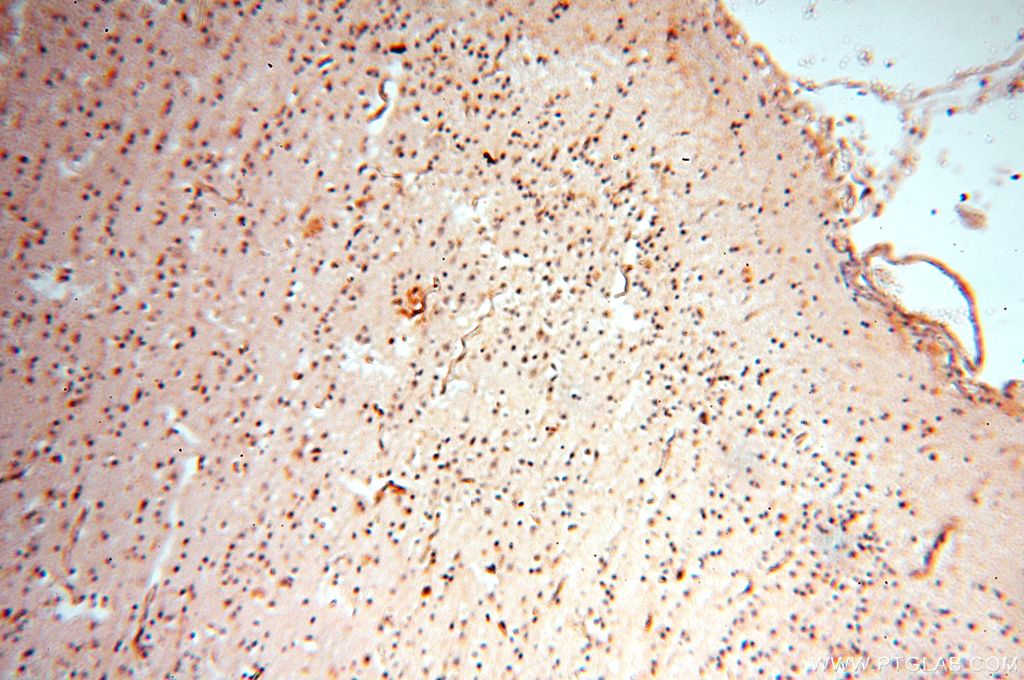 Immunohistochemistry (IHC) staining of human brain tissue using PCSK5 Polyclonal antibody (16470-1-AP)