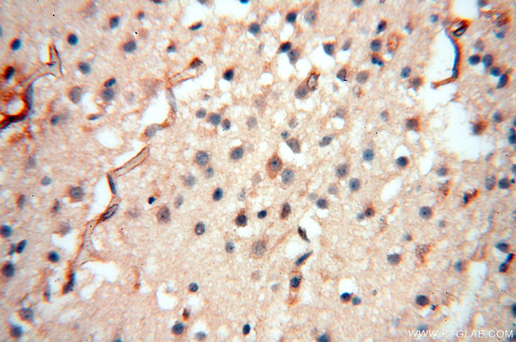 Immunohistochemistry (IHC) staining of human brain tissue using PCSK5 Polyclonal antibody (16470-1-AP)