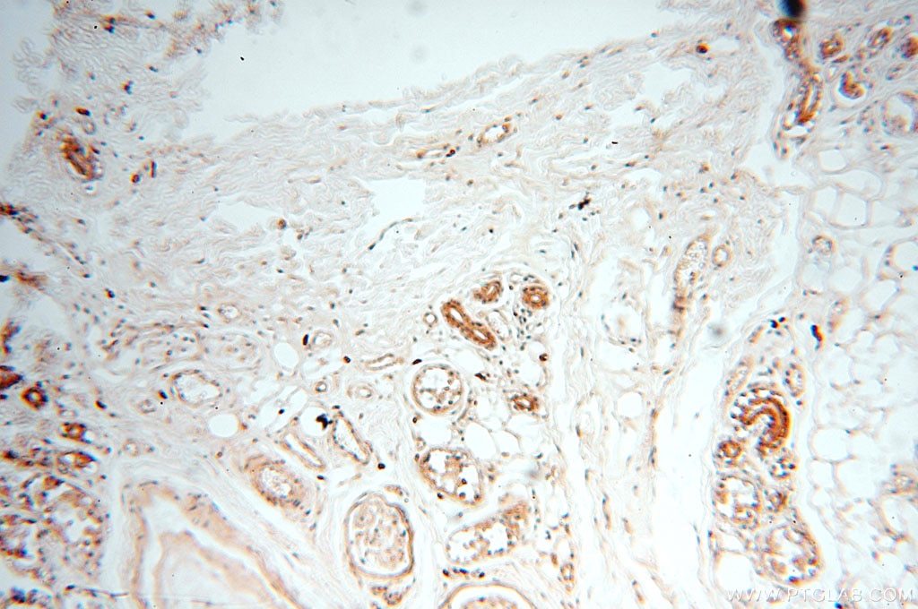 Immunohistochemistry (IHC) staining of human skin tissue using PCSK5 Polyclonal antibody (16470-1-AP)