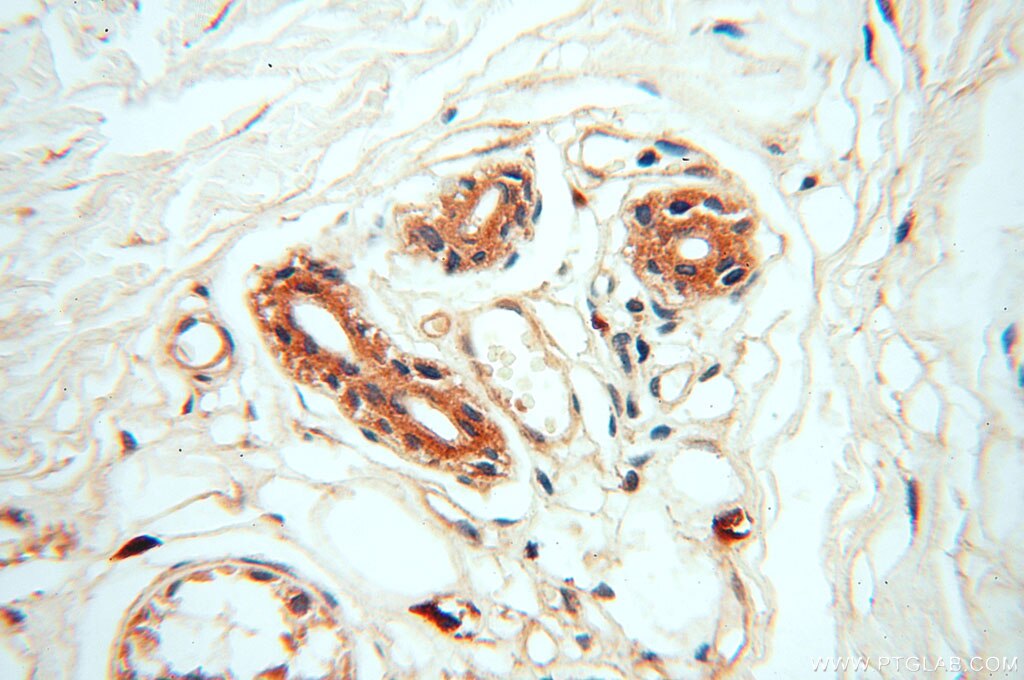 Immunohistochemistry (IHC) staining of human skin tissue using PCSK5 Polyclonal antibody (16470-1-AP)