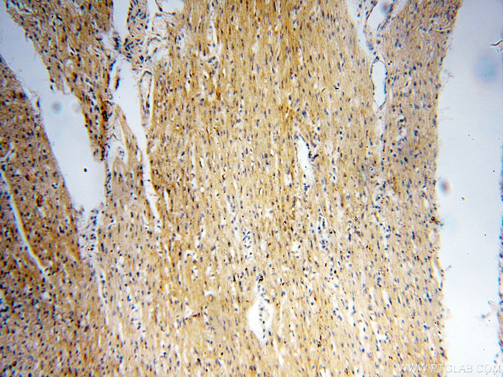 IHC staining of human heart using 16470-1-AP